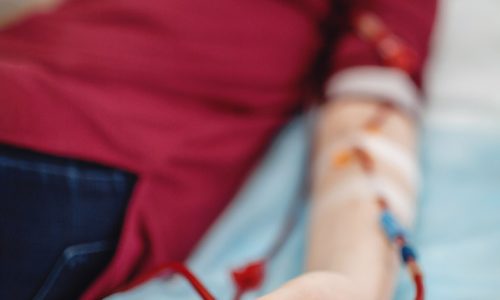 Young beautiful girl, during hemodialysis in hospital, dialysis system equipment, habitual routine for chronic patient, lifestyle, medical concept